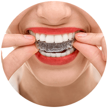 Rubber Bands Blog  Studio Dental of River ParkGet a Brighter Smile with  Our Professional Teeth Whitening Services - Studio Dental of River Park